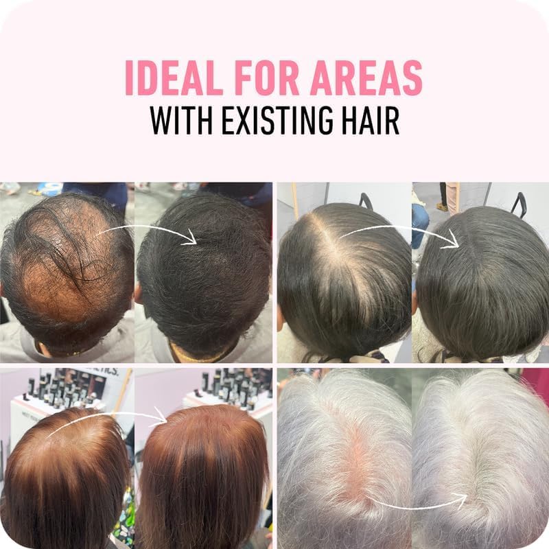 BOLDIFY Hair Fibers (2 x 56g) - Fill In Thinning and Fine Hair for an Instantly Fuller, Thicker Look - 14 Shades for Women & Men - Black - Image 5